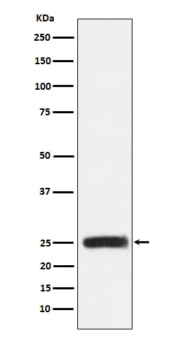 GRB2 Rabbit mAb ABZ4926