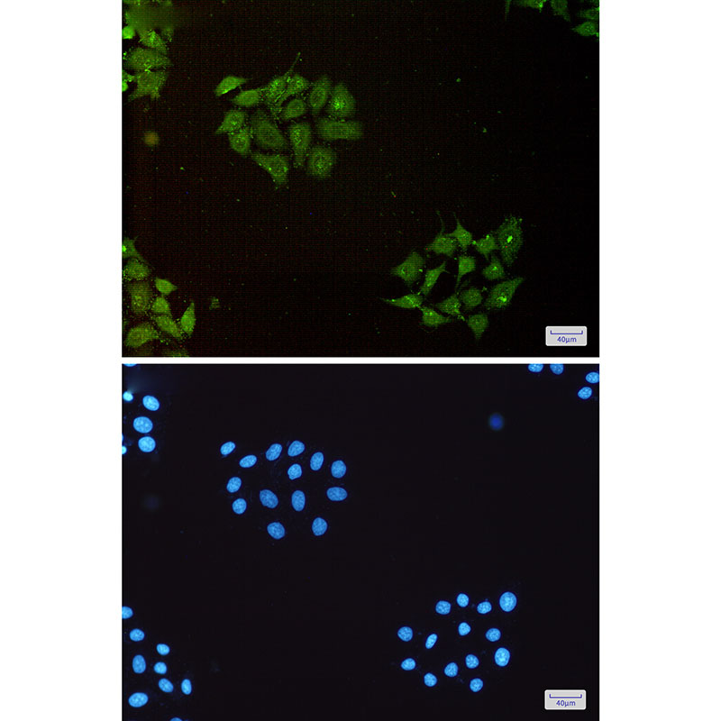 Ubiquitin 60S Ribosomal Protein L40 Rabbit mAb ABZ4927