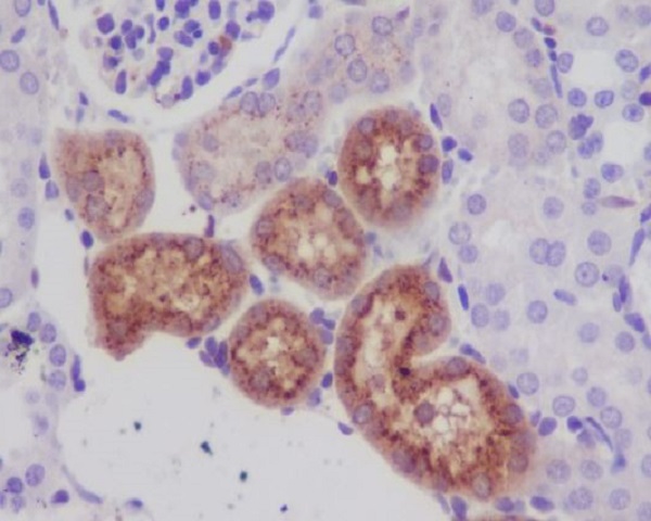 Lysozyme Rabbit mAb ABZ4929
