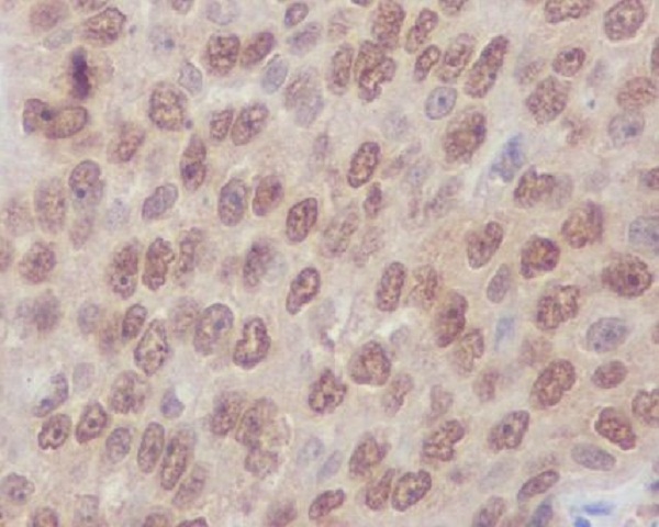 RhoA/B/C Rabbit mAb ABZ4930