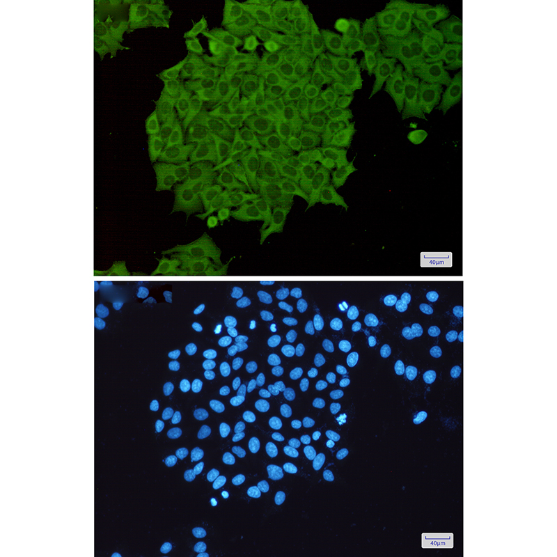 RhoA/B/C Rabbit mAb ABZ4931