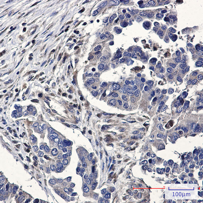 RhoA/B/C Rabbit mAb ABZ4931