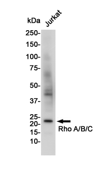 RhoA/B/C Rabbit mAb ABZ4931