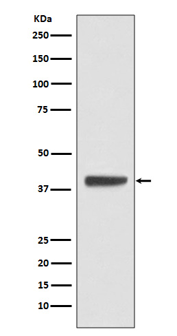 Islet 1 Rabbit mAb ABZ4932