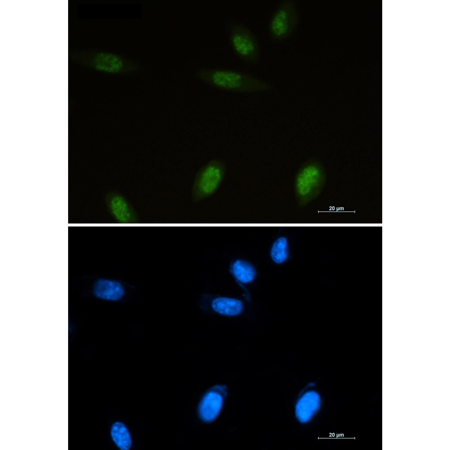 Islet 1 Rabbit mAb ABZ4933