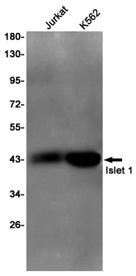 Islet 1 Rabbit mAb ABZ4933