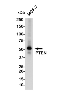 PTEN Rabbit mAb ABZ4934