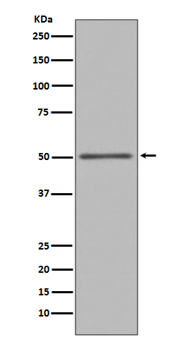 FOXA1 Rabbit mAb ABZ4935