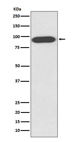 VCP Rabbit mAb ABZ4936