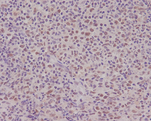 PMS2 Rabbit mAb ABZ4937