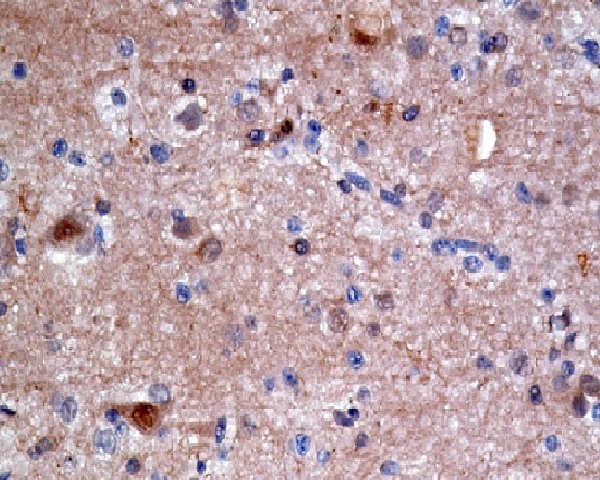 ATP Citrate lyase Rabbit mAb ABZ4938