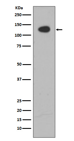 ATP Citrate lyase Rabbit mAb ABZ4938