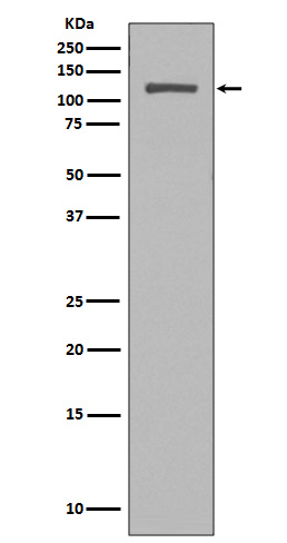 NUP98 Rabbit mAb ABZ4939