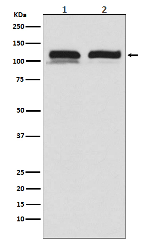 USP11 Rabbit mAb ABZ4940