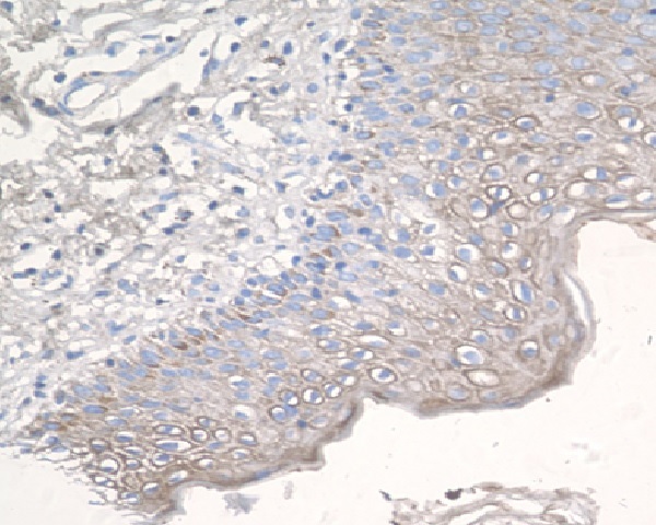 CCR3 Rabbit mAb ABZ4941