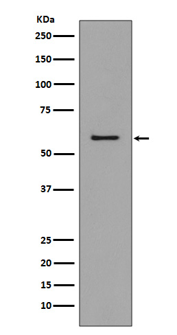 CCR3 Rabbit mAb ABZ4941