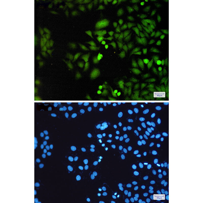 DUSP3 Rabbit mAb ABZ4942