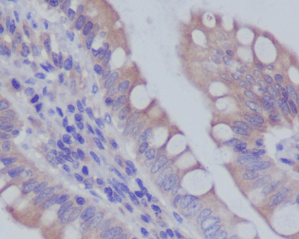 Rab7 Rabbit mAb ABZ4943