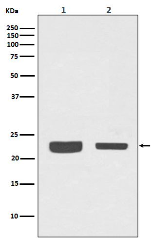 Rab7 Rabbit mAb ABZ4943