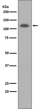 ABCG1 Rabbit mAb ABZ4947