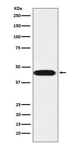 LIS1 Rabbit mAb ABZ4949