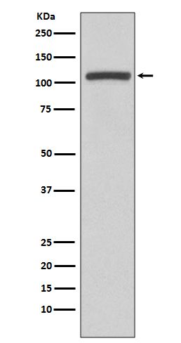 PI3 Kinase p110 beta Rabbit mAb ABZ4950