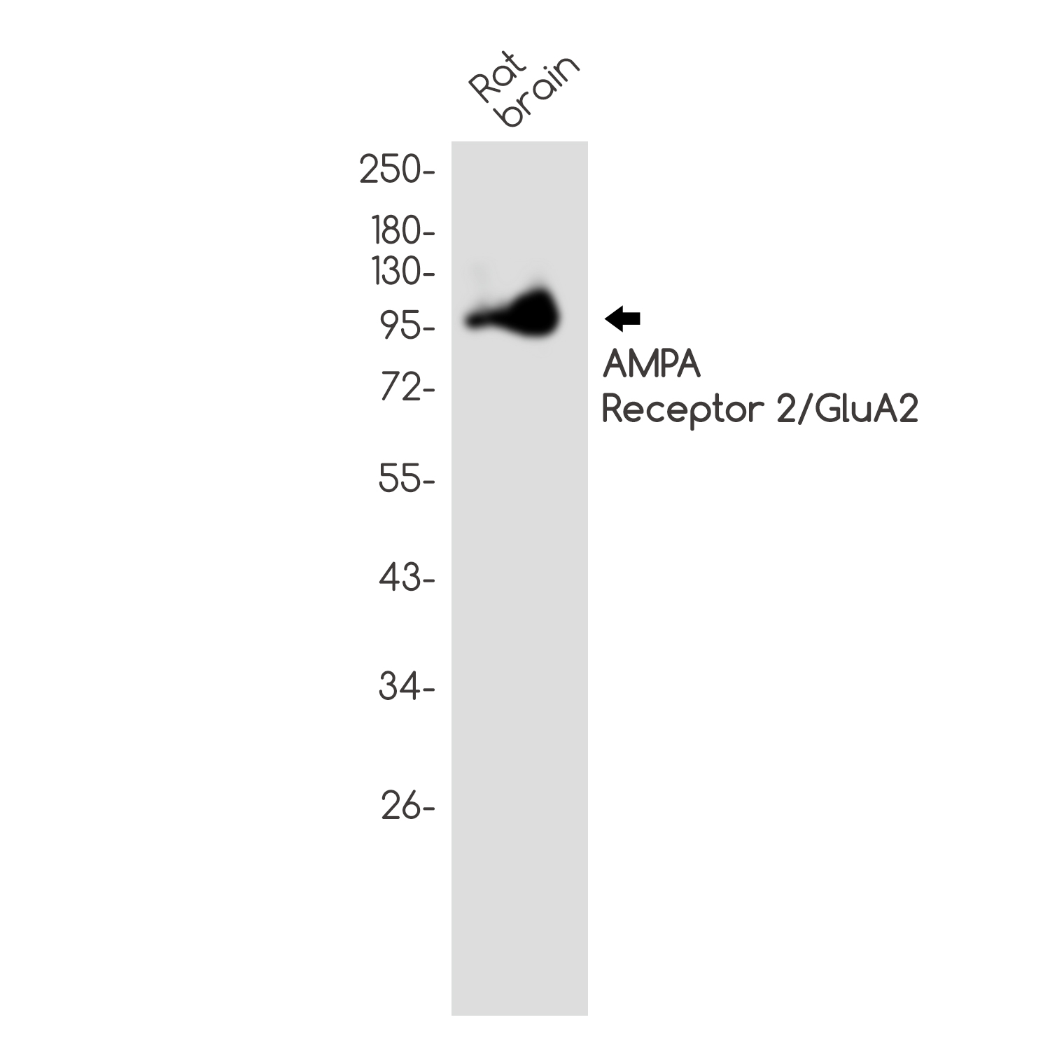 Glutamate receptor 2 Rabbit mAb ABZ4951