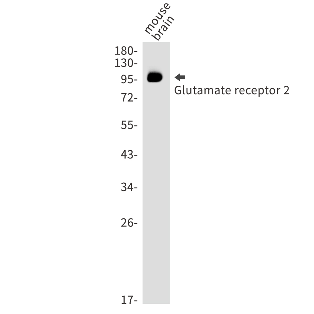 Glutamate receptor 2 Rabbit mAb ABZ4951