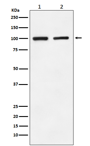 Glutamate receptor 2 Rabbit mAb ABZ4952