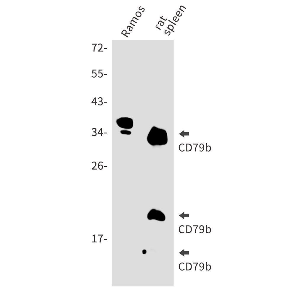 CD79B Rabbit mAb ABZ4953
