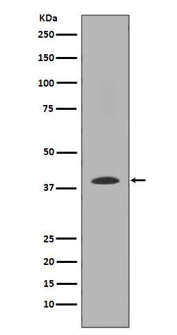 MMP12 Rabbit mAb ABZ4955