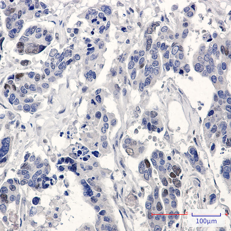 p21 Rabbit mAb ABZ4956