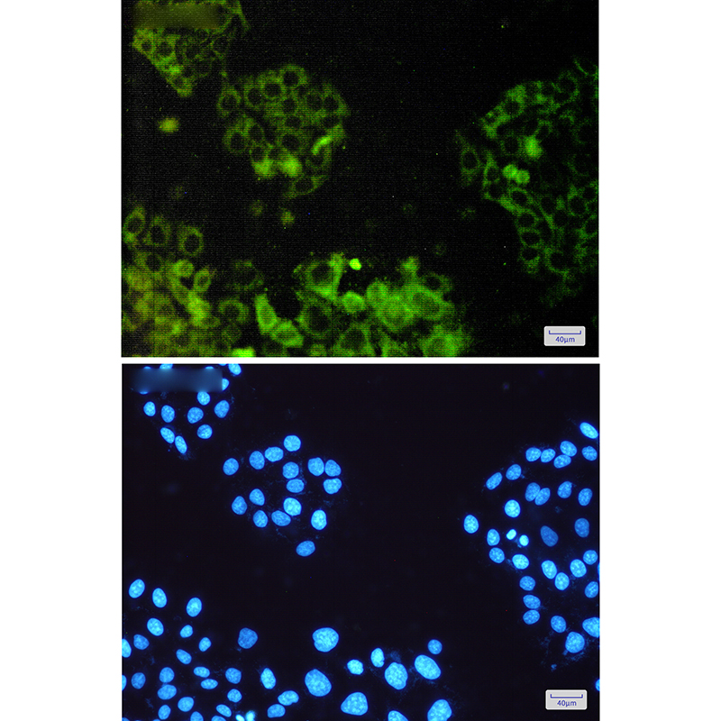 ATP6V1E1 Rabbit mAb ABZ4958
