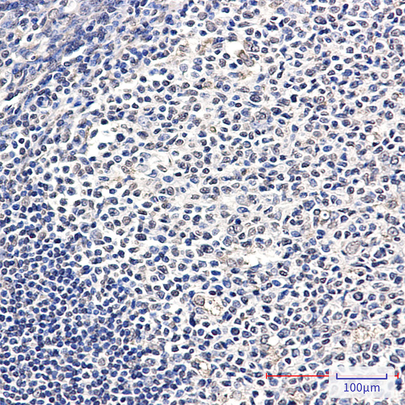 ATP6V1E1 Rabbit mAb ABZ4958