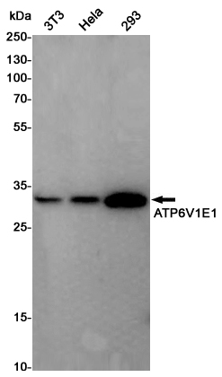 ATP6V1E1 Rabbit mAb ABZ4958