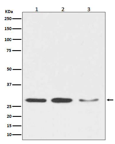 DDIT3 Rabbit mAb ABZ4960