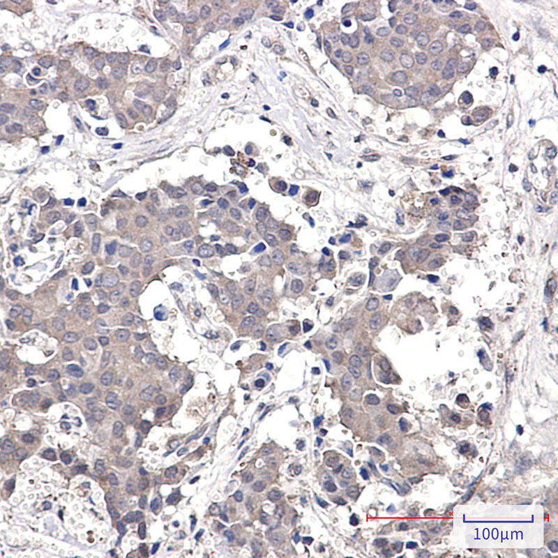 GRK3 Rabbit mAb ABZ4961