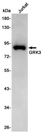 GRK3 Rabbit mAb ABZ4961