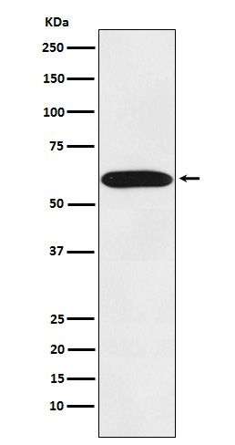 STIP1/STI1 Rabbit mAb ABZ4962