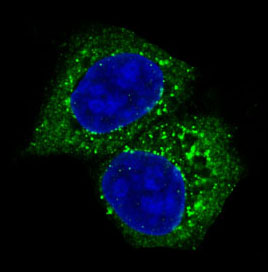AKT1/2/3 Rabbit mAb ABZ4964