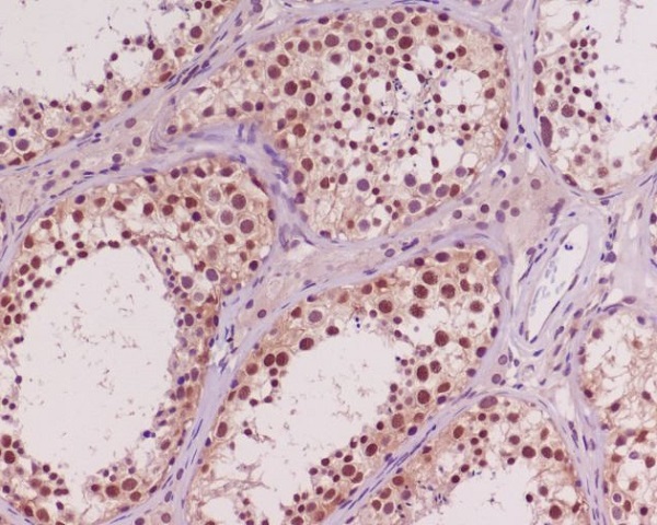 AKT1/2/3 Rabbit mAb ABZ4964