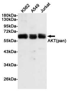 AKT1/2/3 Rabbit mAb ABZ4964