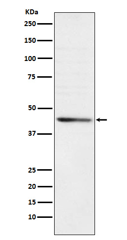 RRM2 Rabbit mAb ABZ4965