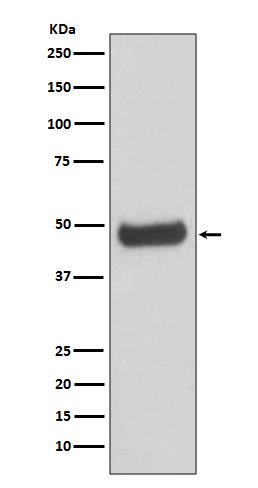 PRKAR2B Rabbit mAb ABZ4966