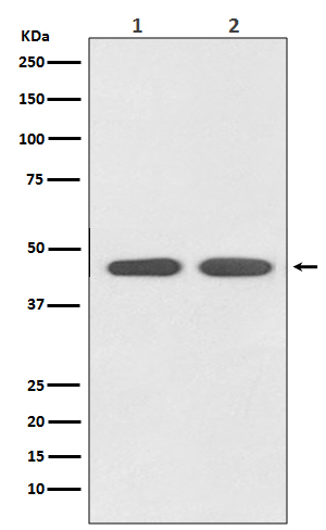 Angiotensin II Type 1 Receptor Rabbit mAb ABZ4967