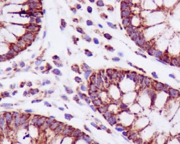 TSPO/PBR Rabbit mAb ABZ4968