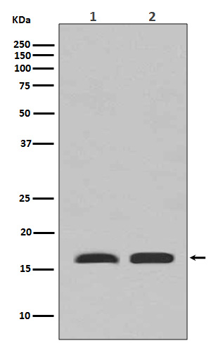 TSPO/PBR Rabbit mAb ABZ4968
