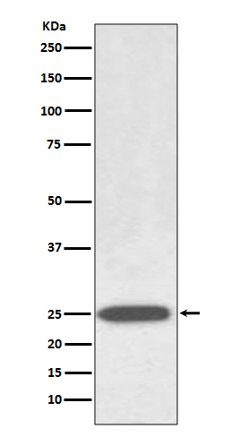 Aquaporin 1 Rabbit mAb ABZ4969