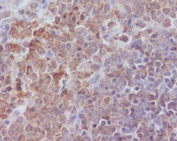 SHP1 Rabbit mAb ABZ4970
