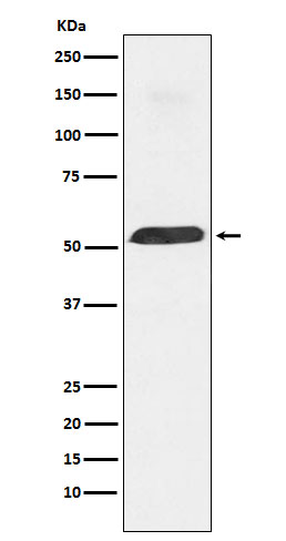 PTBP1 Rabbit mAb ABZ4972